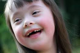 Primo piano sorridente di una bambina con sindrome di Down